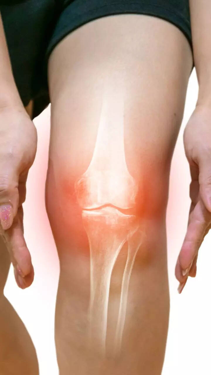9 Foods You Should Eat To Keep Your Bones Healthy | Times Now