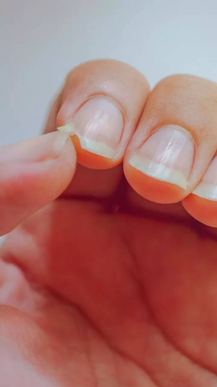 6 Nail Health Lessons - Clues From Your Cuticles