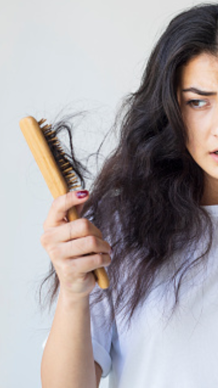 Hair Fall Solution | DIY Hair growth oil for extreme hair fall | Times Now