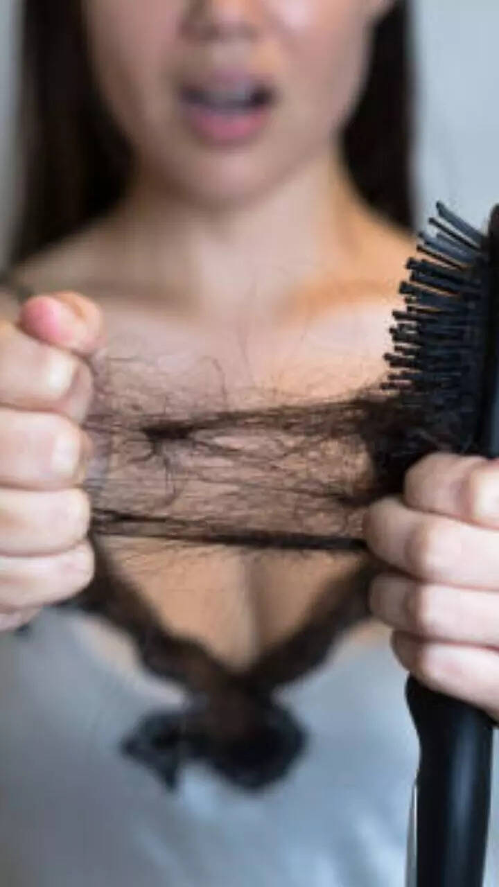 Eating sweet potato may help with hair fall issues, other food items to help in hair growth | Times Now Eating sweet potato may help with hair fall issues, other food items to help in hair growth | Times Now