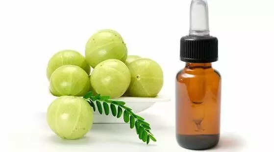 Amla oil not only rejuvenates but adds strength and shine to your hair as well Pic Credit curlynikkicom