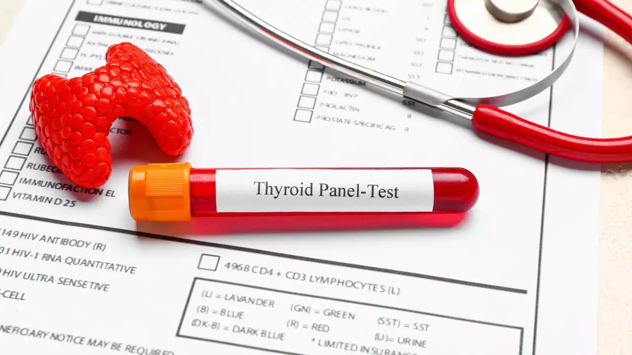 Thyroid Function Testing