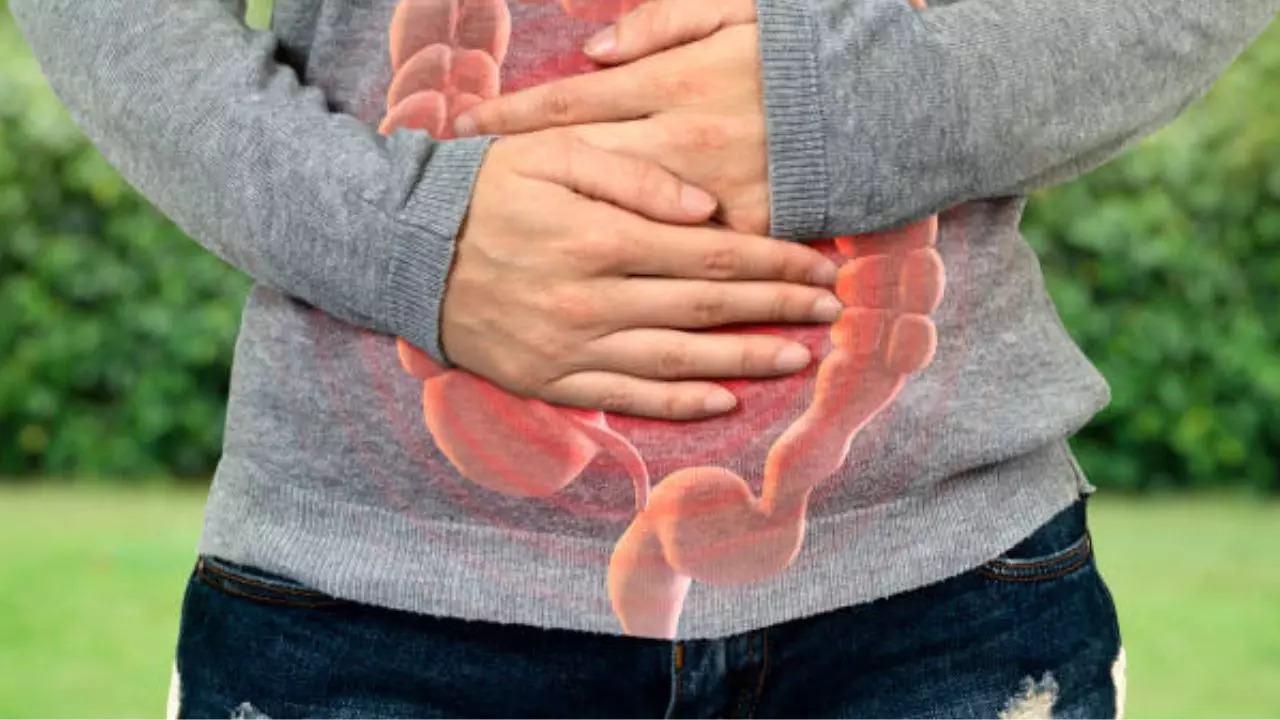 Signs and symptoms of bowel cancer