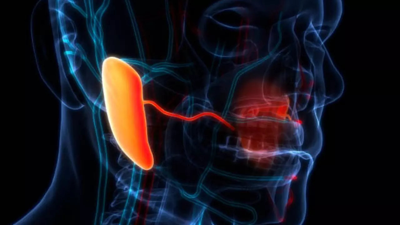 Salivary gland cancer