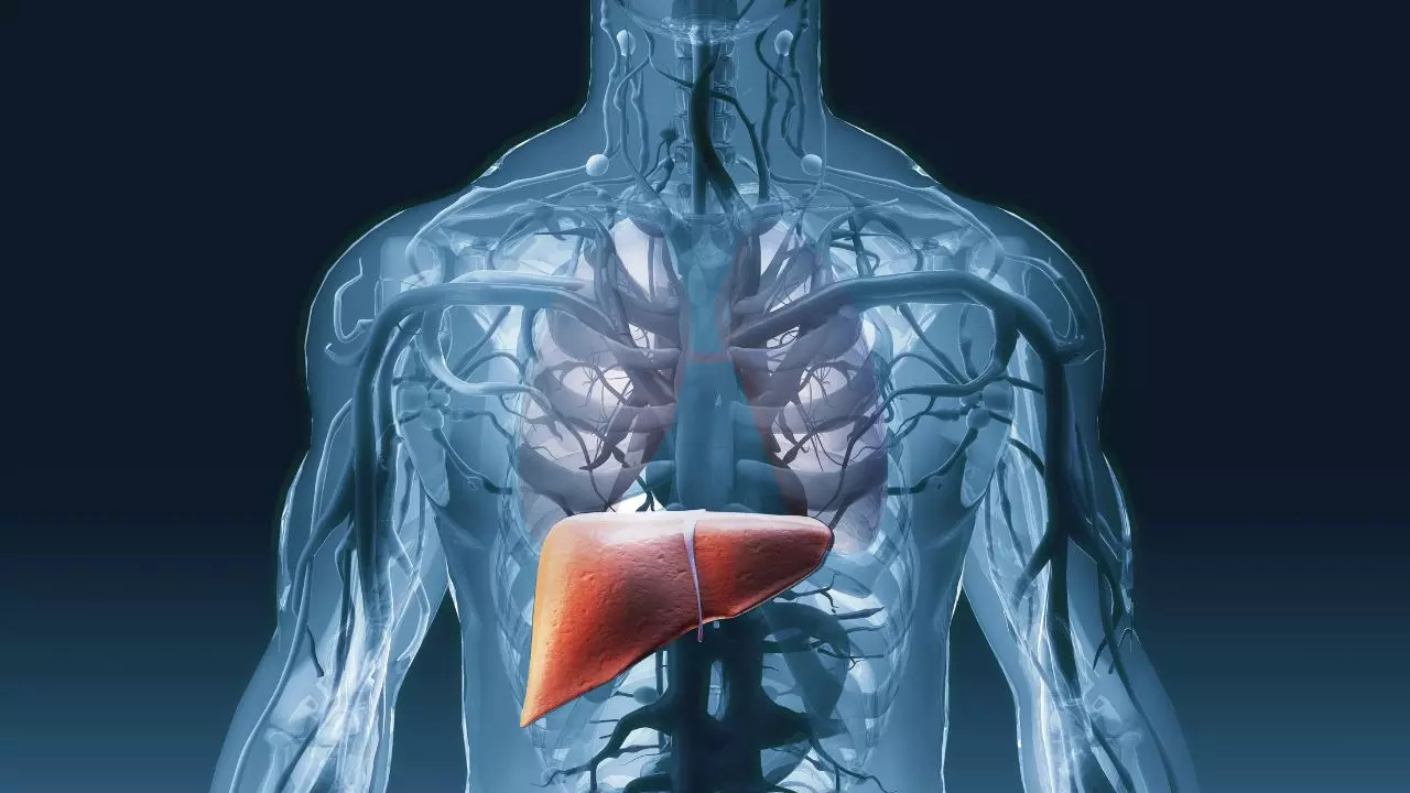 Understanding liver cirrhosis