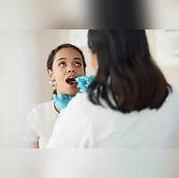 Scientists Developing Lollipops That Can Diagnose Mouth Cancer Even Before The Symptoms Show