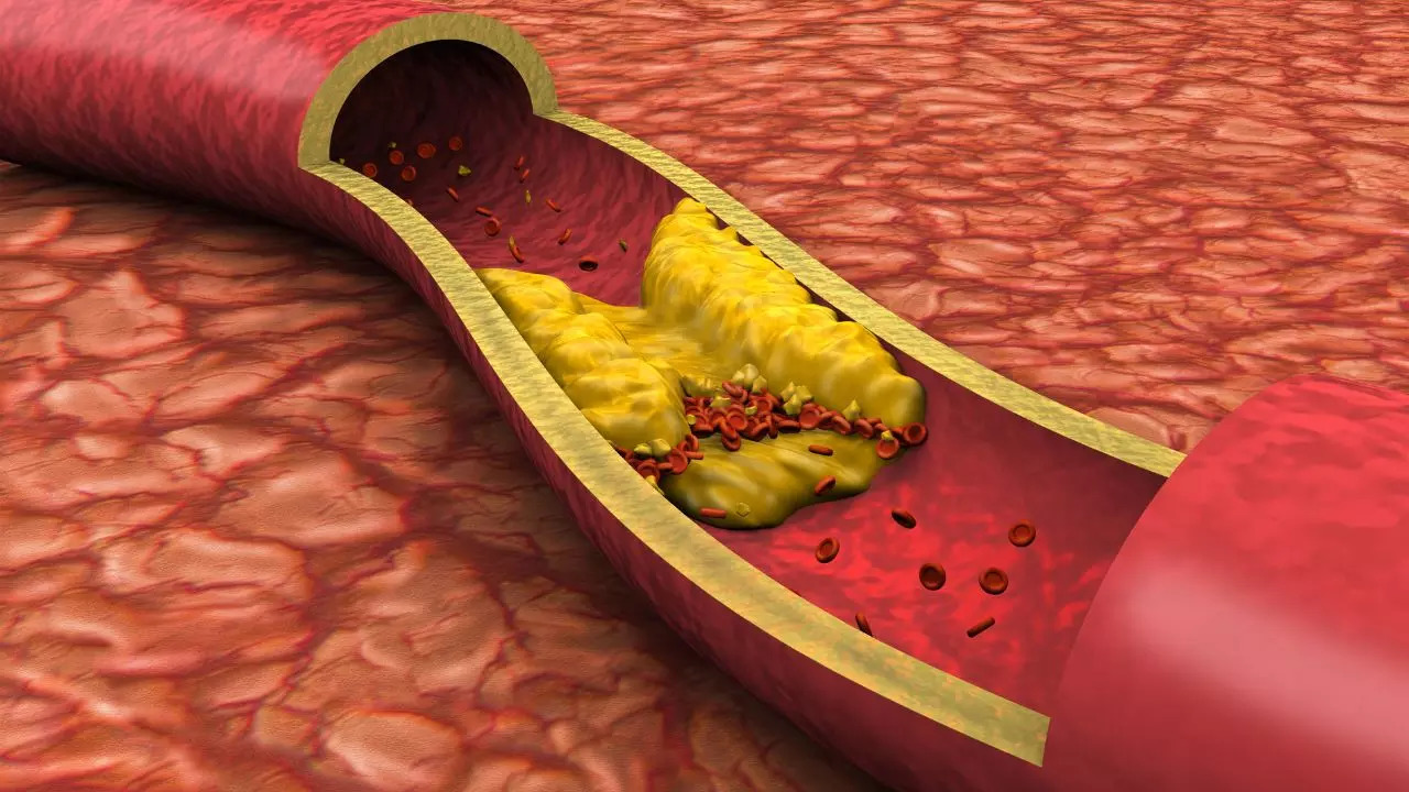 Cholesterol Check