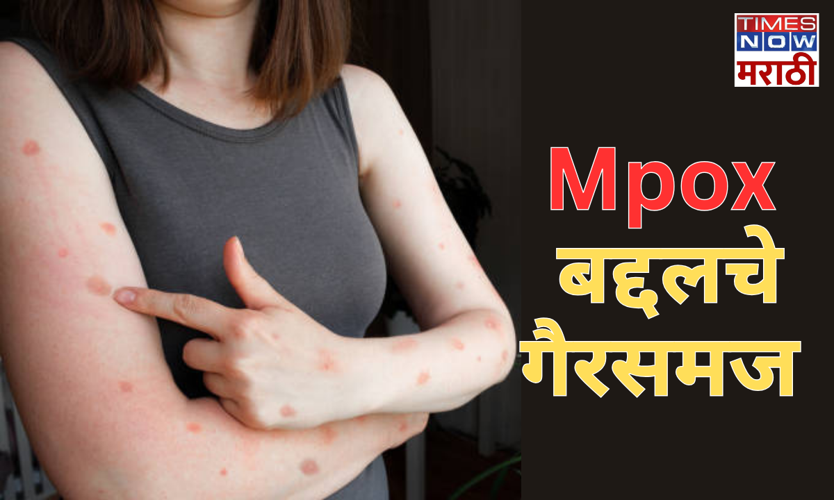 मंकीपॉक्स संबंधित मिथक