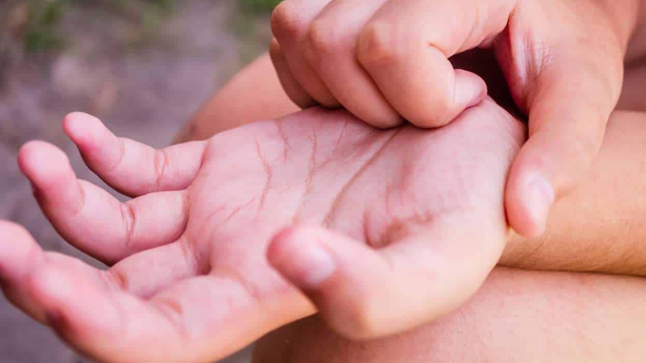 तळहाताला खाज का सुटते  Causes Of Itching Palms Of Hands Itching in Palm Reasons