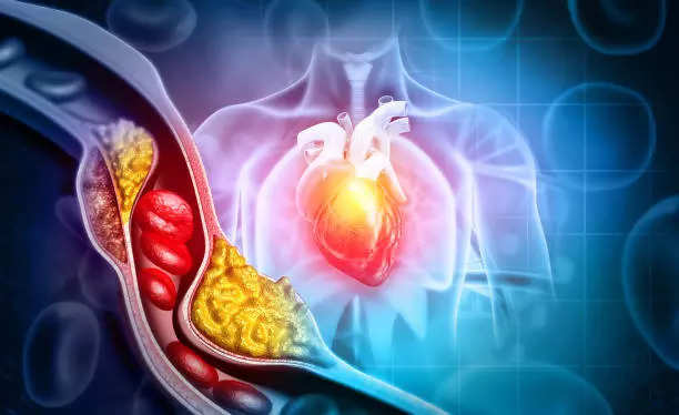 C Cholesterol ची पातळी वाढणे धोकादायक