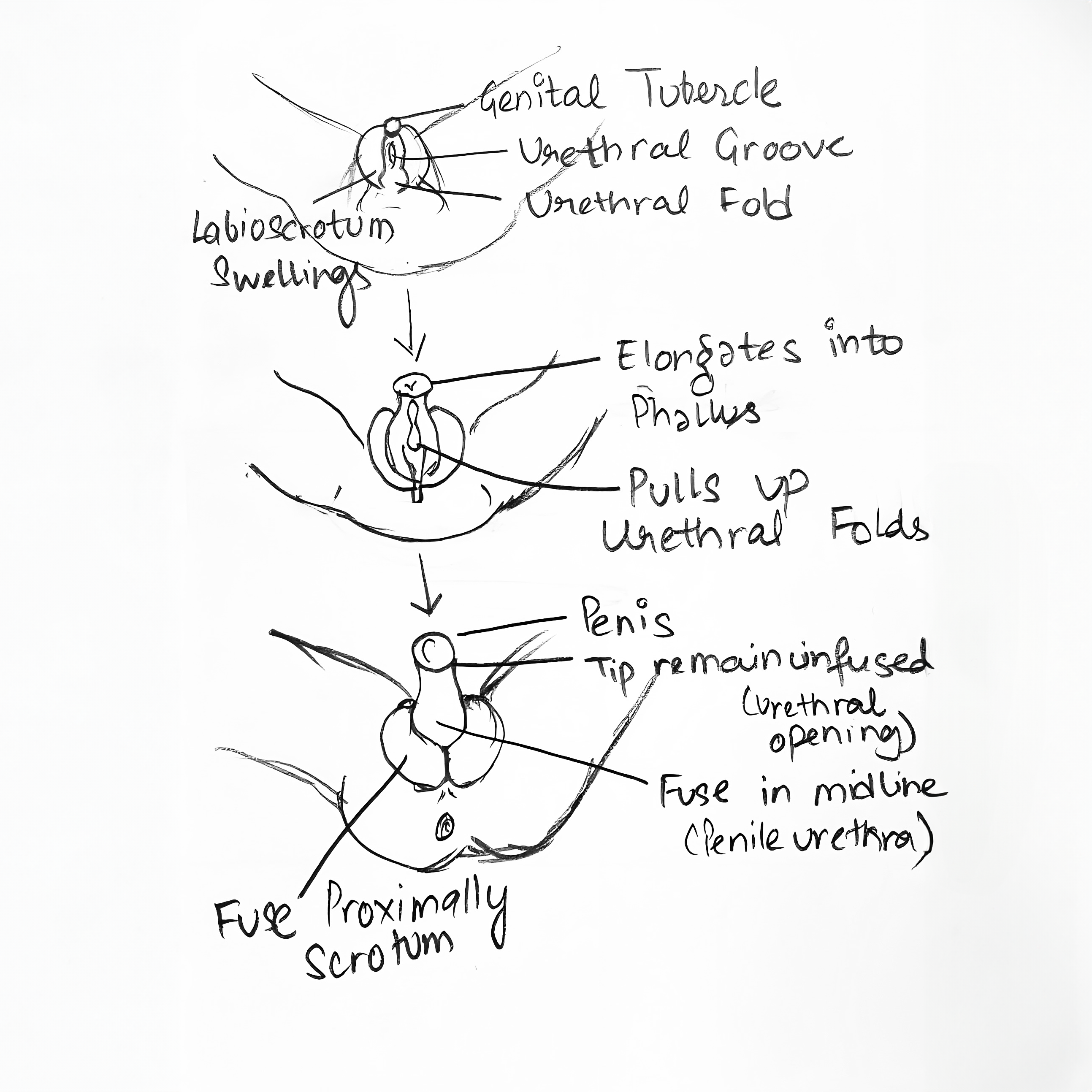 Genitalia and how it changes in the fetus