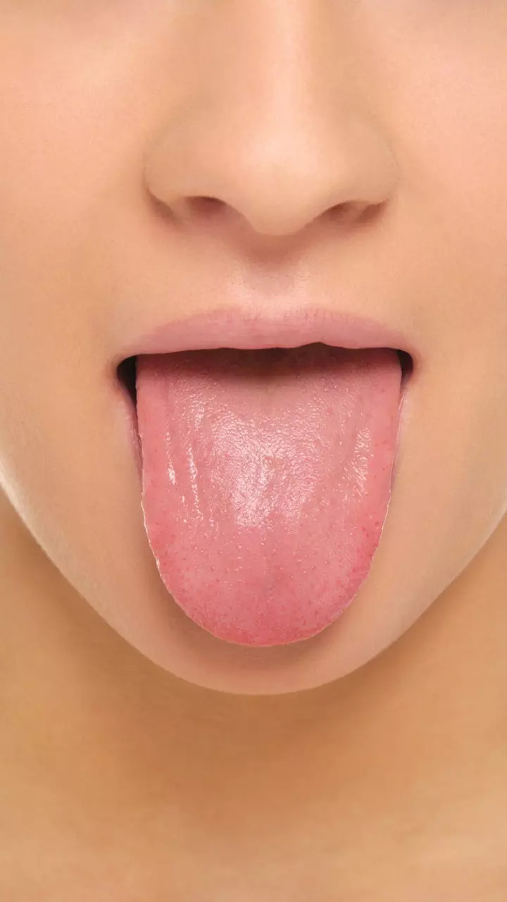 You have a unique tongue