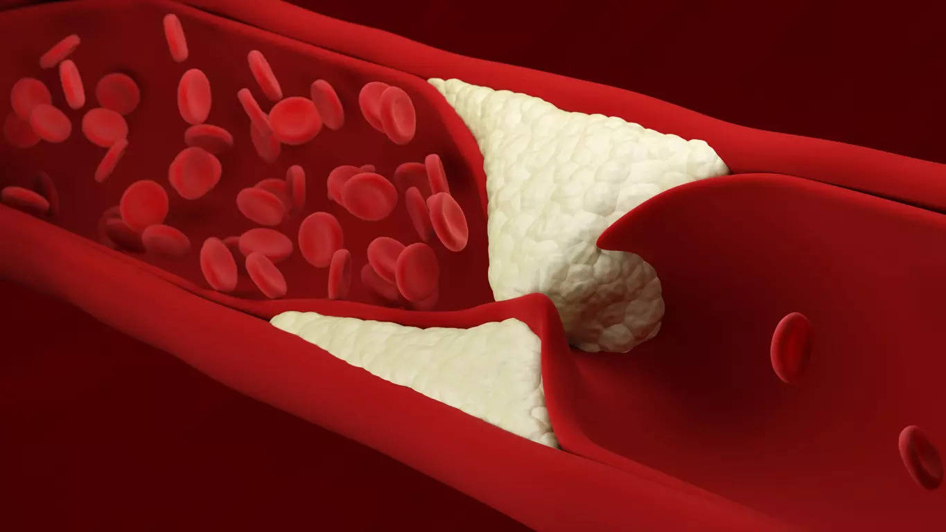 Cholesterol is a waxy substance found in the blood that helps build cell membranes.