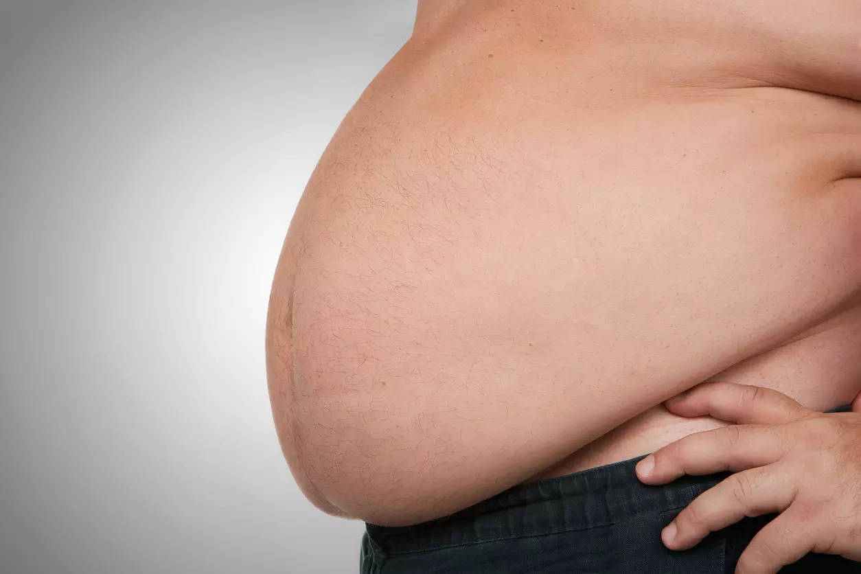 The apple shape belly is known as beer belly. It refers to excessive fat being stored around the stomach while the lower body continues to be slim.
