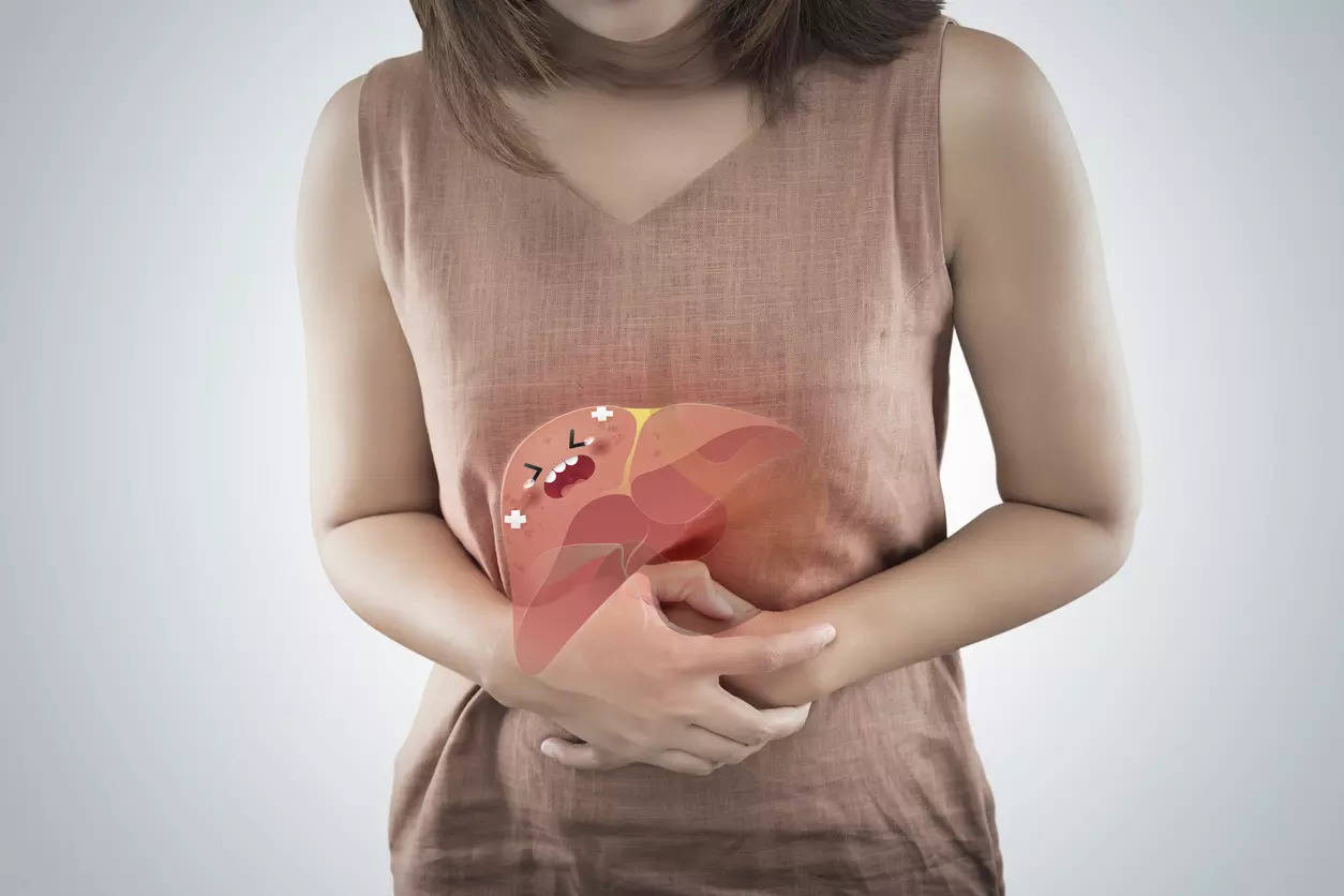 Liver woman cirhossis NAFLD NASH