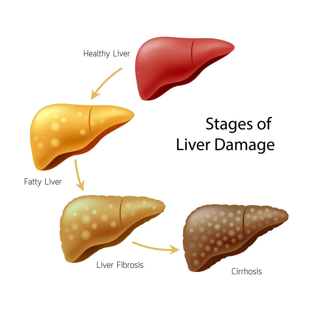 stages-of-liver-damage-this-figure-shows-how-normal-my-xxx-hot-girl