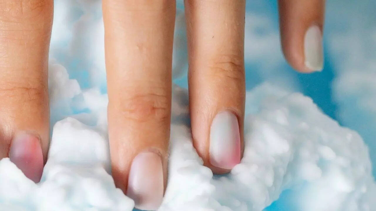 Got yellow stains on your nails? Here are DIY hacks you need to know Got yellow stains on your nails? Here are DIY hacks you need to know