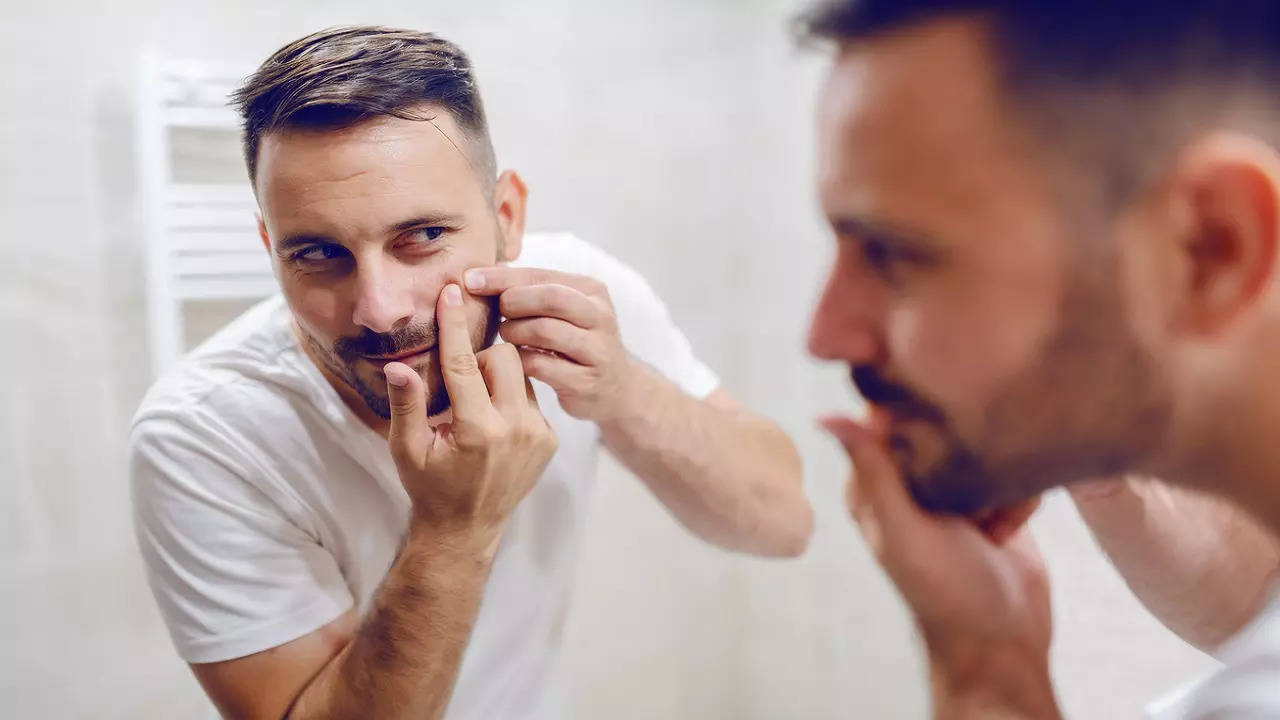 Here's how men can cure their stubborn acne scars