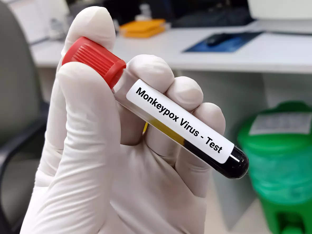 No monkeypox case recorded in India yet: ICMR
