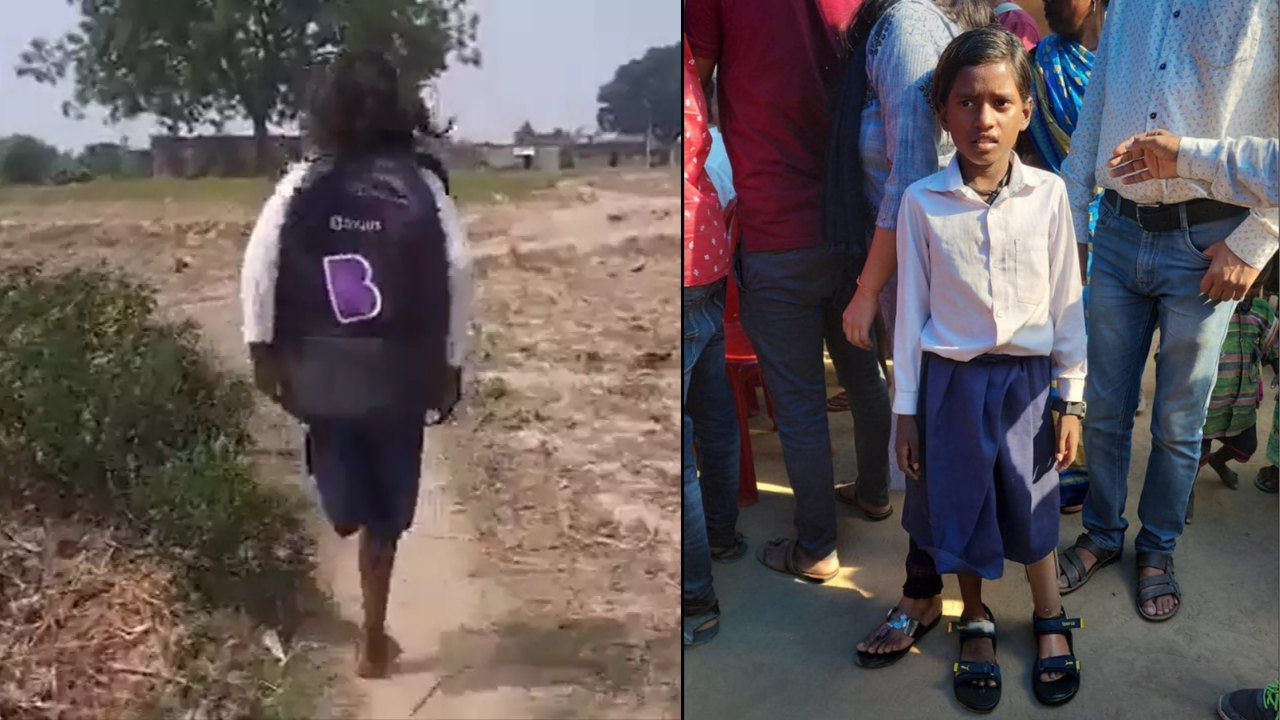 Bihar girl who walked 1 km on 1 leg gets prosthetic leg