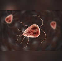 Giardiasis All about the parasitic infection