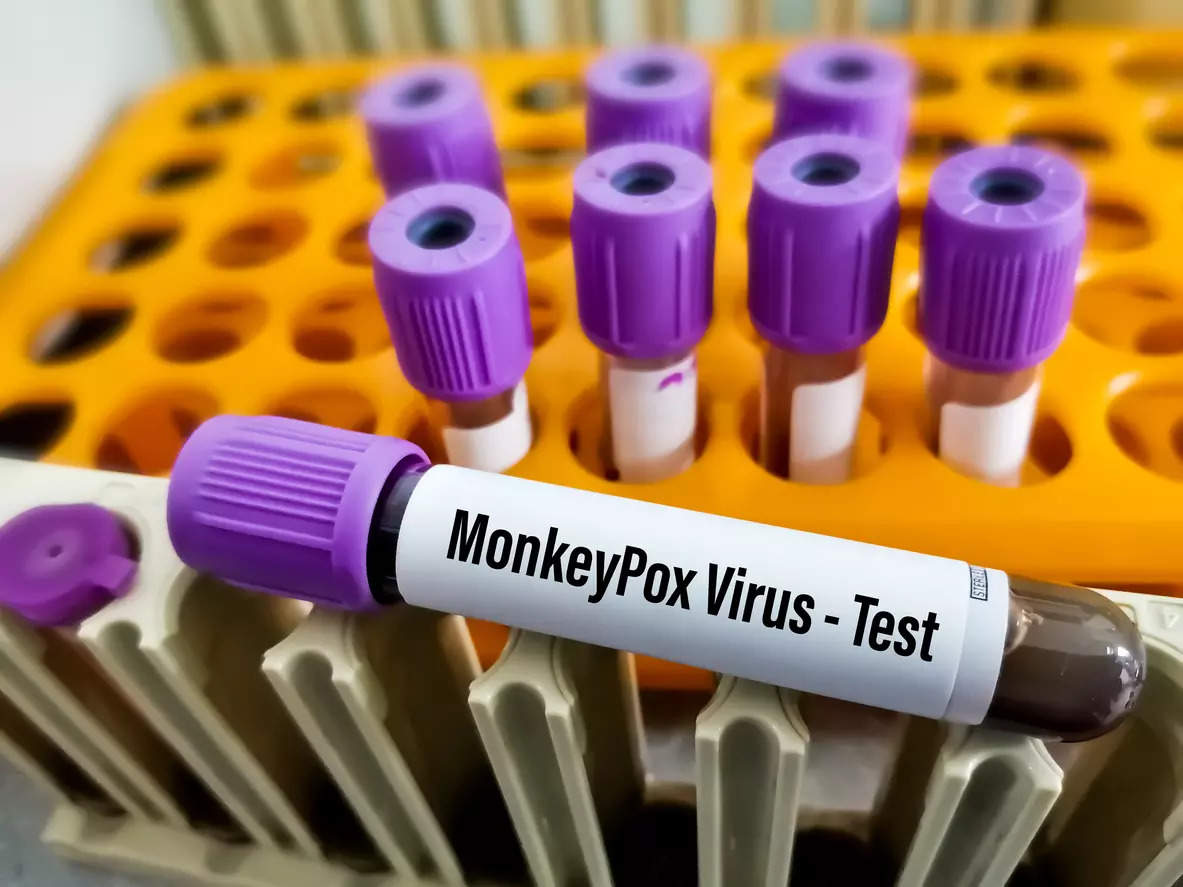 Советы по отпугиванию обезьяньей оспы, чтобы избежать заражения вирусом