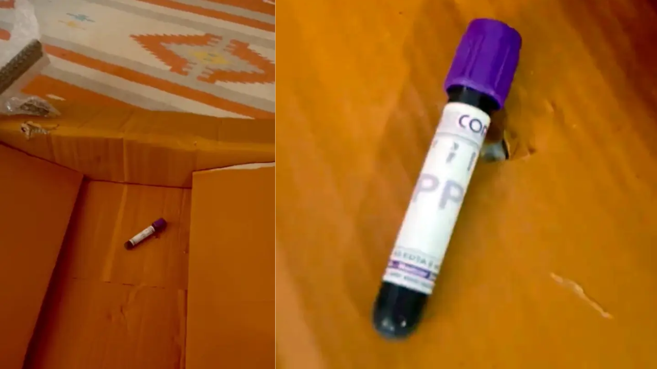Woman orders chair on Amazon, receives vial of blood along with it
