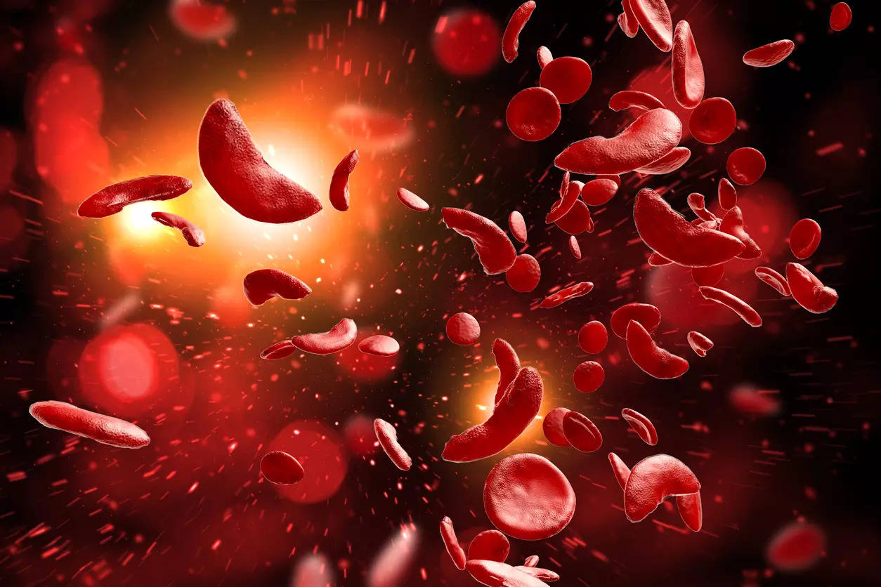 World Sickle Cell Day 2022: 3 common myths about the disease busted!