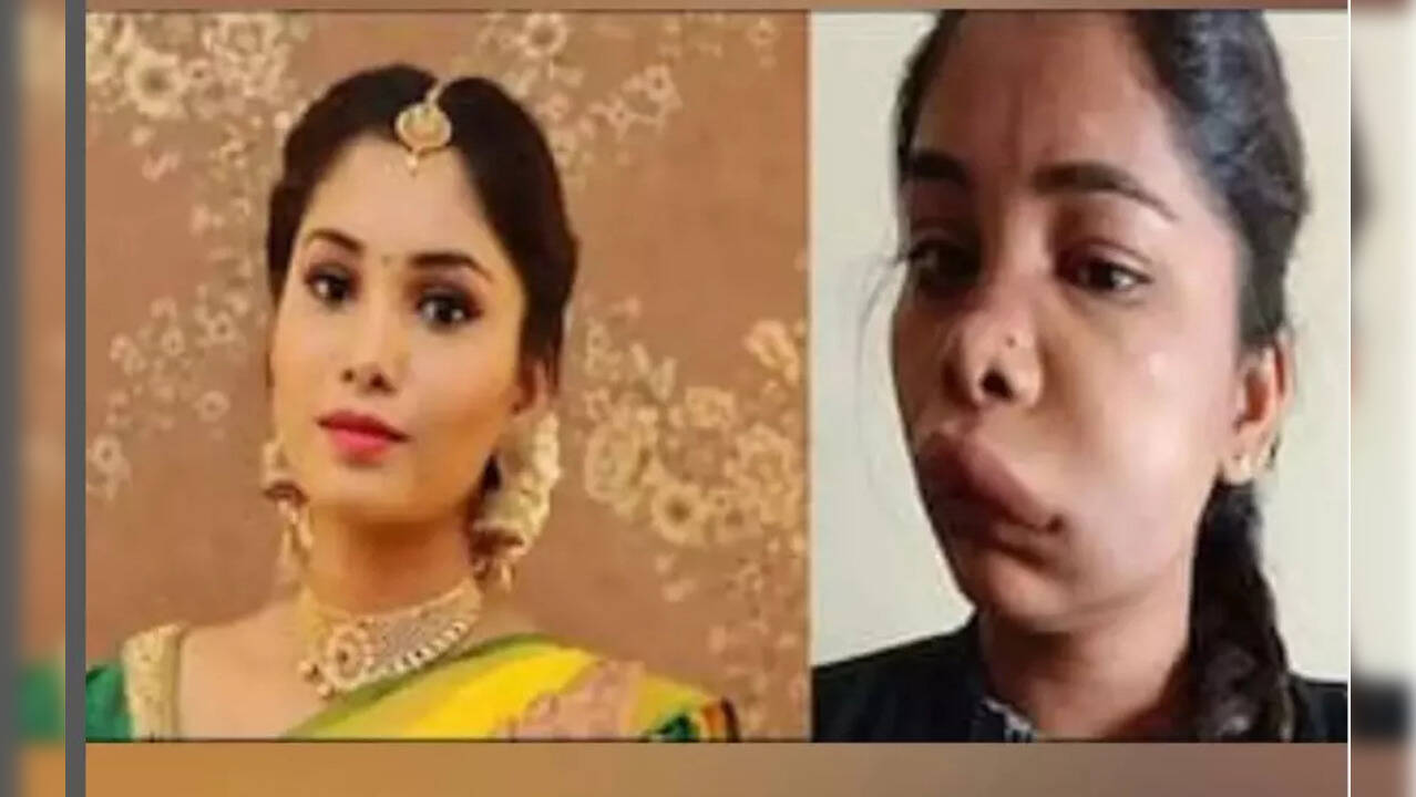 Is Root Canal surgery dangerous? Lessons learnt from Kannada actress