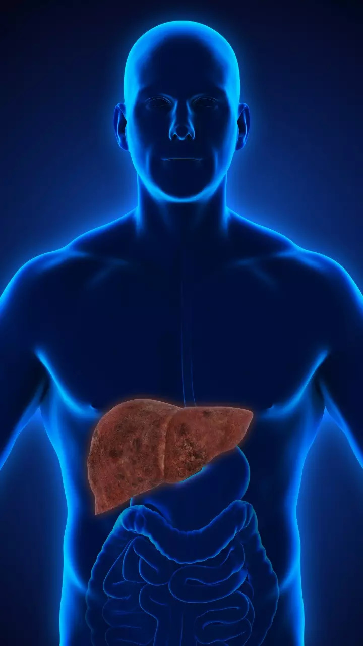 Fatty liver disease explained