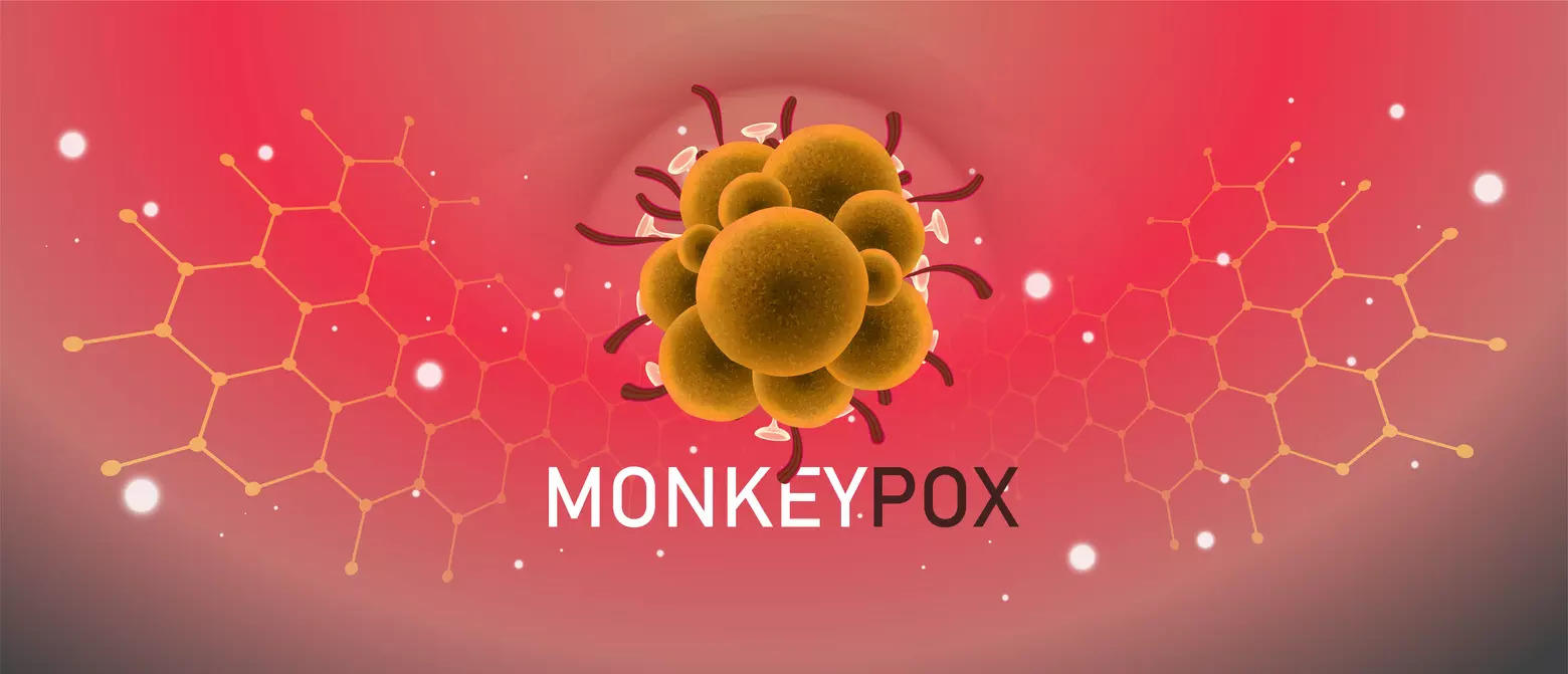 Monkeypox fever