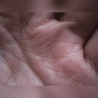 Why do my palms always feel sweaty?