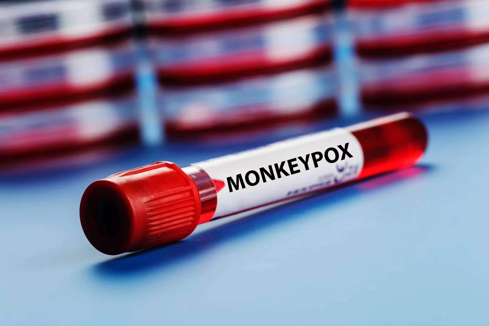 India registers second monkeypox case Centre asks for strict health screening of international travellers