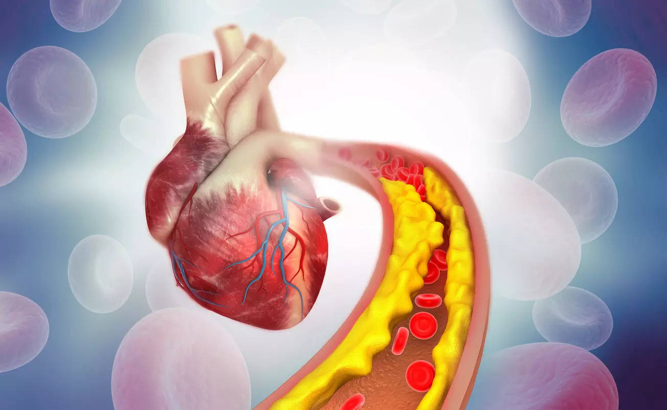 Understand how cholesterol damages the heart and what lifestyle changes can reverse it