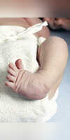 All You Should Know About Clubfoot The Leg Deformity In Babies And Its Cures All You Should Know About Clubfoot The Leg Deformity In Babies And Its Cures