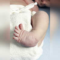 All you should know about Clubfoot, the leg deformity in babies, and
