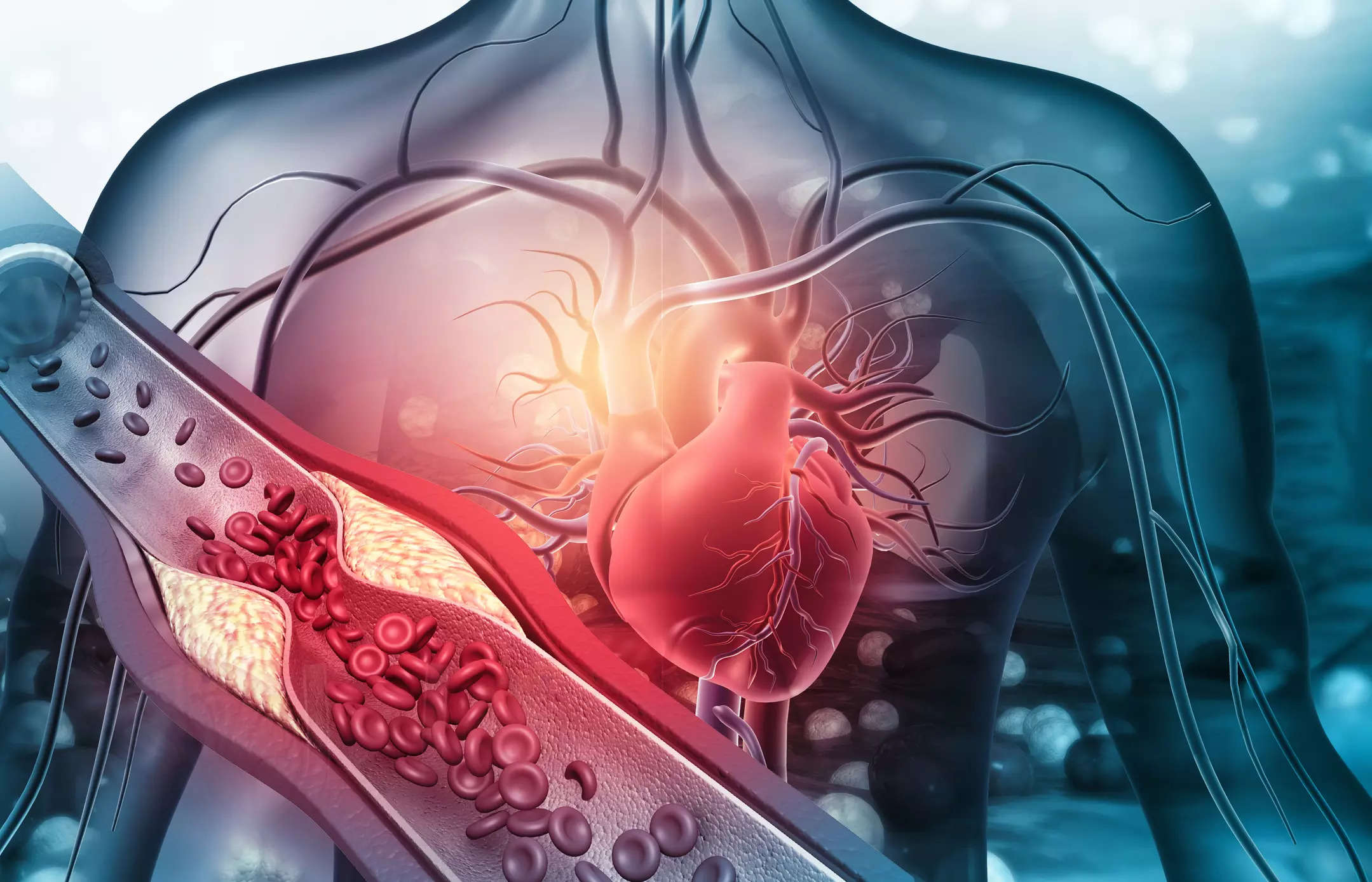 HIIT can be intense for heart patients with severe cardiovascular conditions – acute or chronic. Although performing HIIT can be beneficial for heart patients, it is important to be mindful of certain things before proceeding.