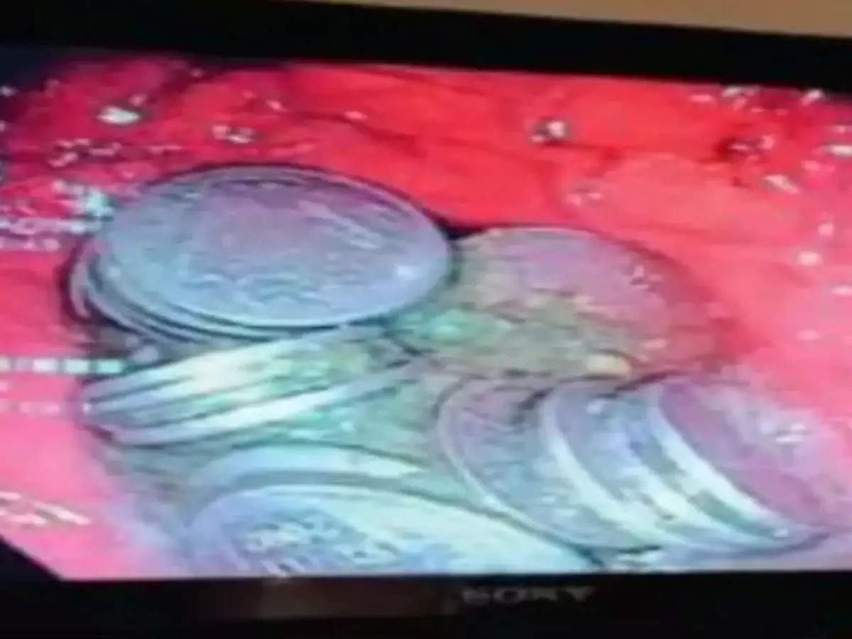 An endoscopic view of the metallic lump of 63 coins in the man's stomach removed by doctors
