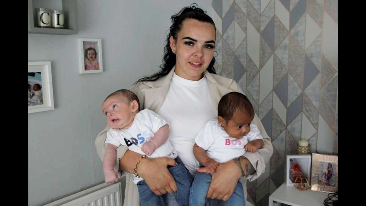 Woman gives birth to a million black and white twins