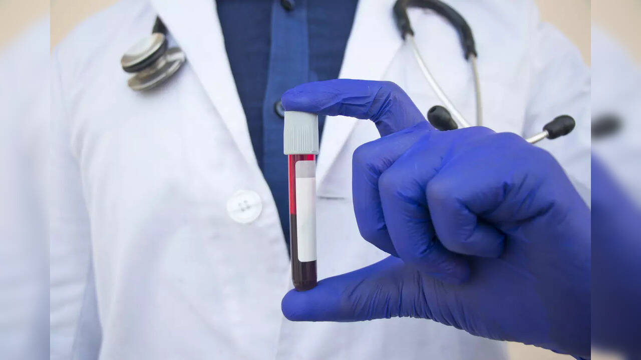 Study finds how early blood tests can predict death for traumatic brain