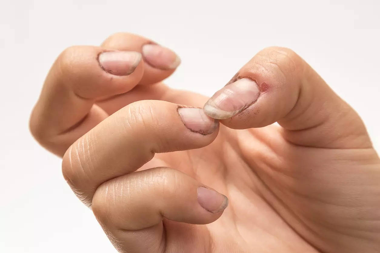 Brittle and peeling nails? Tips to strengthen them