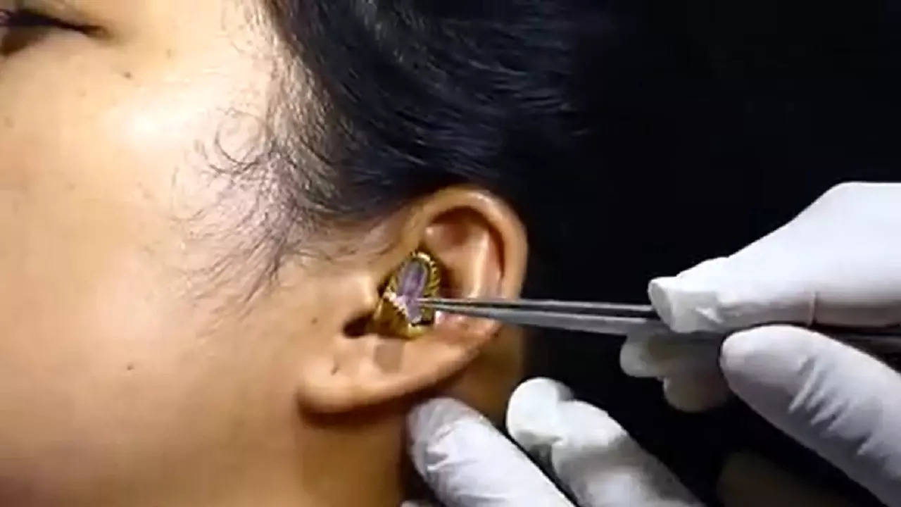 Watch Snake gets stuck inside womans ear netizens are shocked  disgusted
