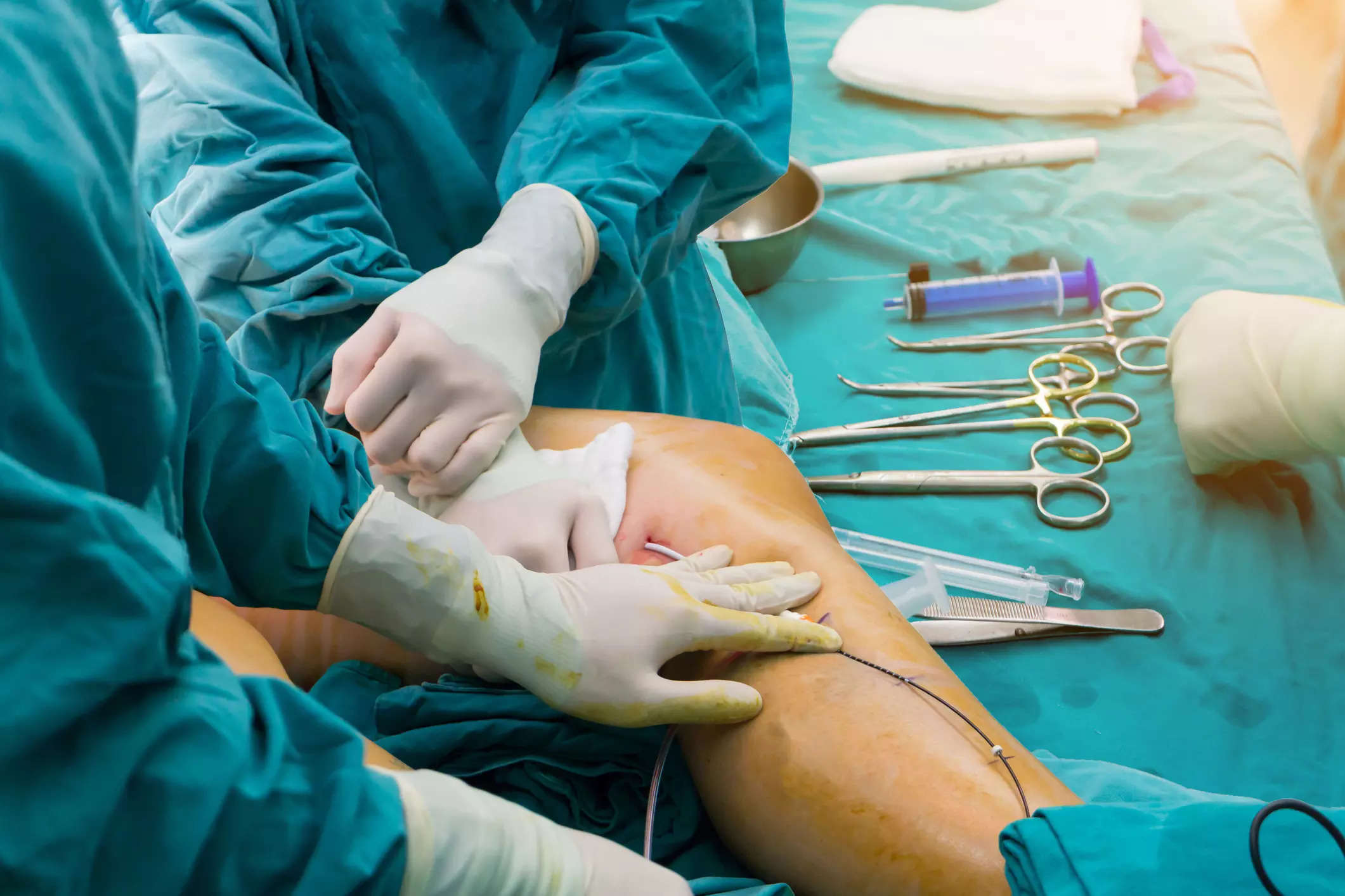 Limb lengthening surgery is a strange and complicated procedure that uses the body's ability to regenerate new bone, ligaments, blood vessels, soft tissue and nerves to support and surround the new structure