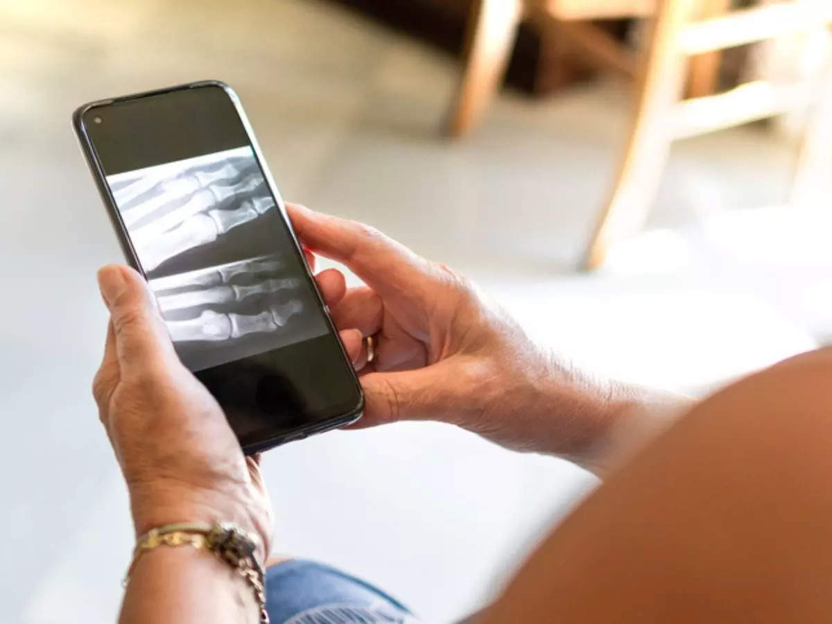 Punjab: A government hospital in Patiala cites shortage of X-ray films as its reason to only allow patients with smartphones to get diagnosed | Representative image