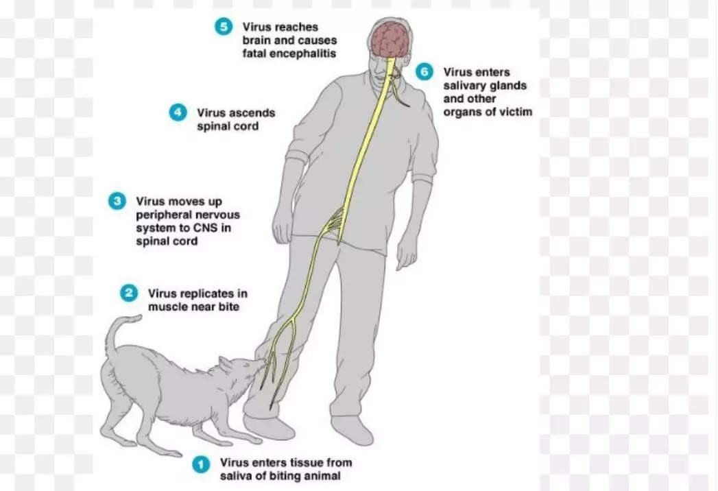 World Rabies Day: After dog bite, virus can lie dormant in human body and  can kill after years; do not skip full vaccine: Experts