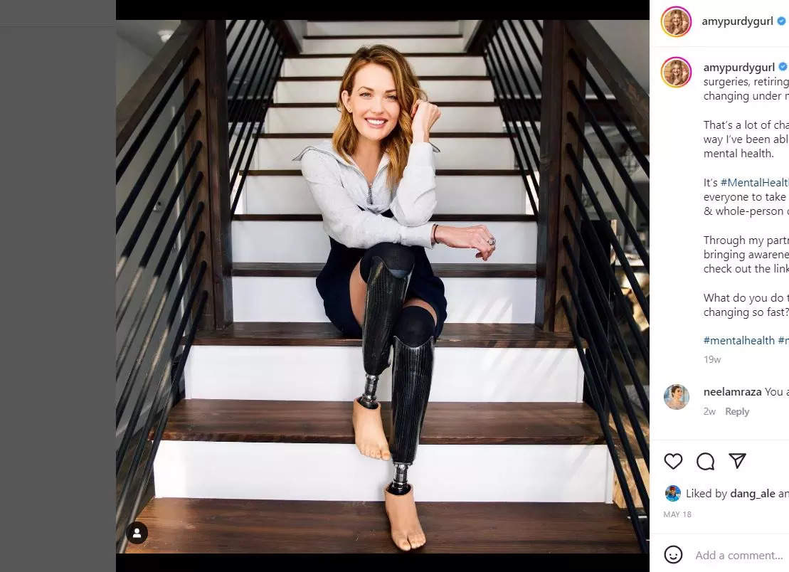 Amy Purdy - champion paralympian - teaches stress relief