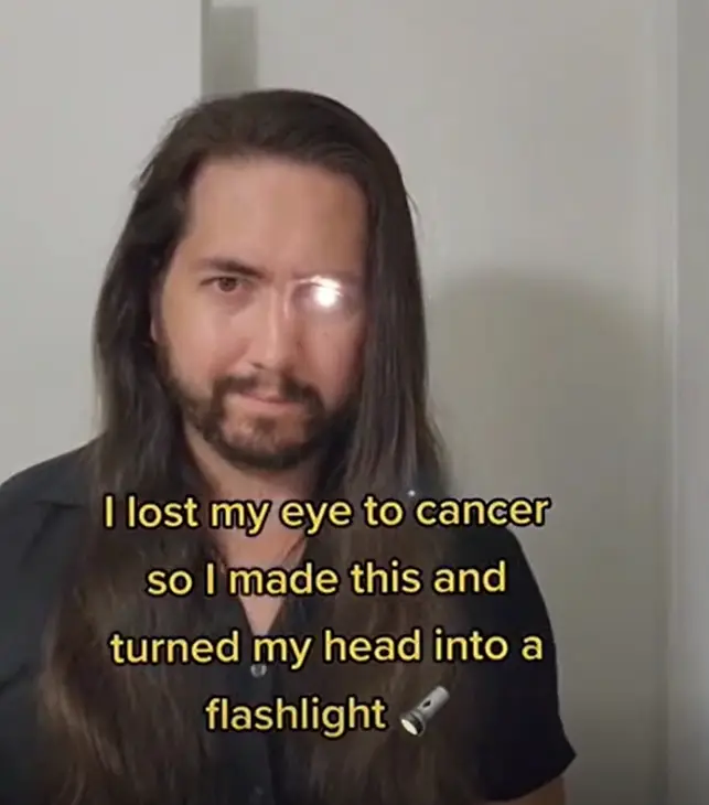 Man turns his right eye into a flashlight after losing it to cancer