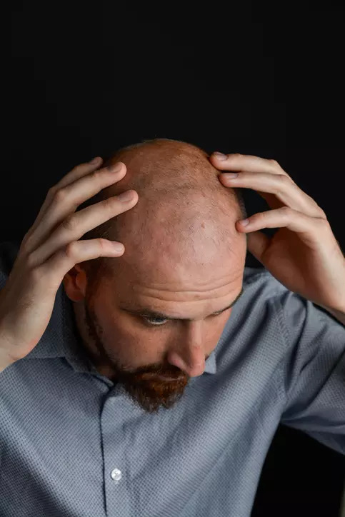 Tips to reduce hair fall in men