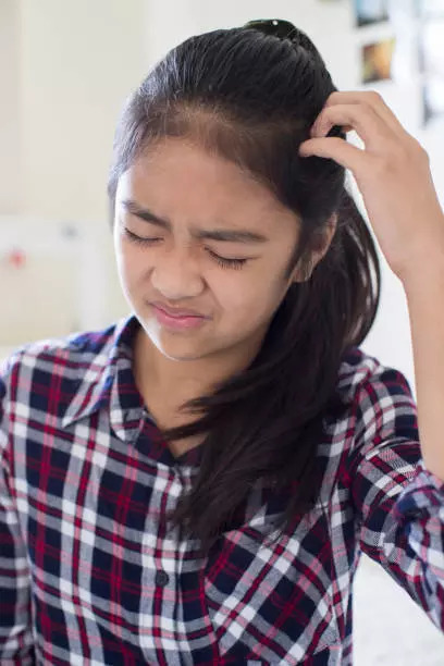 Dandruff is an embarrassing skin condition