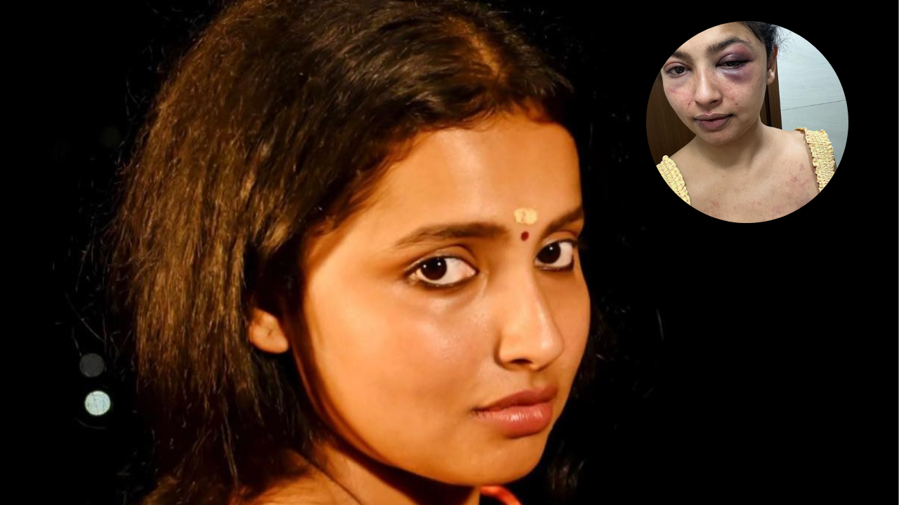 Malayalam actress Anicka Vikhraman shares SHOCKING details of abusive  relationship: He abused me mentally, physically